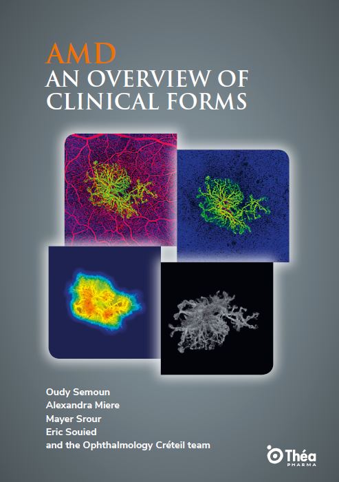AMD_an_overview_of_clinical_forms
